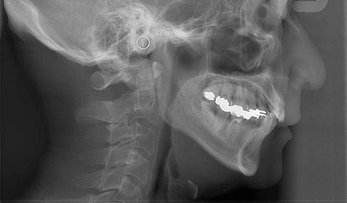 千葉市緑区高田町・たかだの森歯科・セファロ