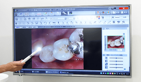 千葉市緑区高田町・たかだの森歯科・口腔内カメラ